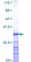 Human GPR37L1 Protein (Recombinant GST, N-terminus)