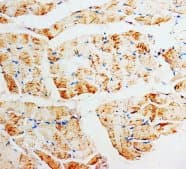 PMVK Antibody (Internal, Magnetic beads)
