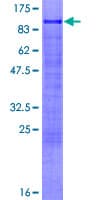 Human ZNF777 Protein (Recombinant GST)