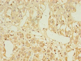 LDAH Antibody