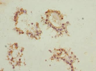 EIF2B1 Antibody
