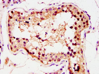 GSC / Goosecoid Antibody