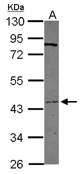 Polyclonal Rabbit anti-Human TMPRSS11D / HAT Antibody (IHC, WB)