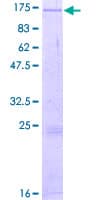 Human DGKZ Protein (Recombinant GST)