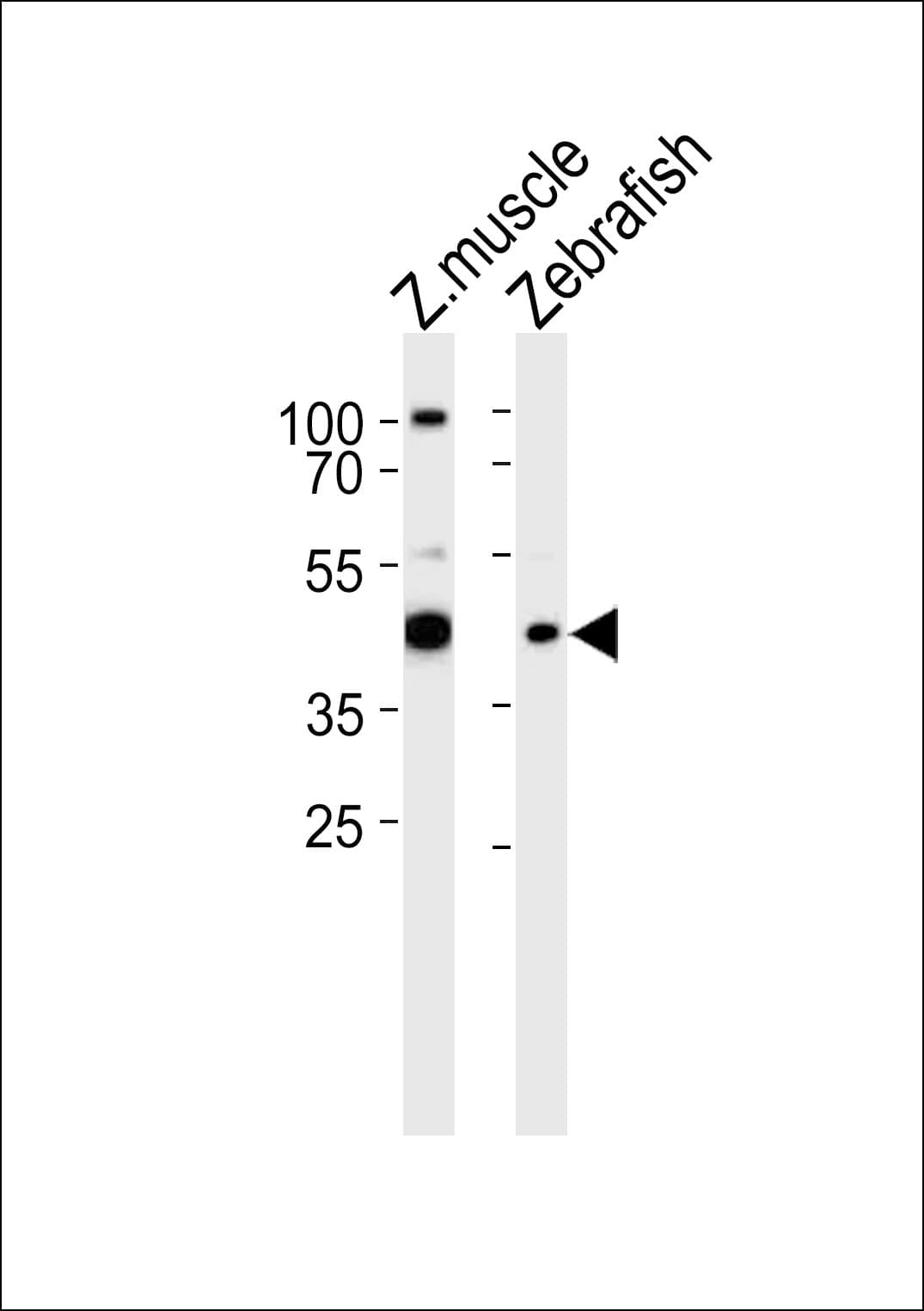 Polyclonal Rabbit anti-Human RBM22 Antibody (aa165-193, IHC, WB)