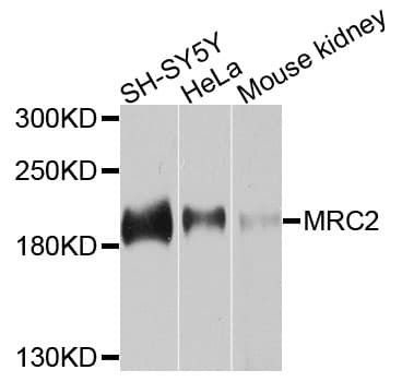 MRC2 / Endo180 Antibody
