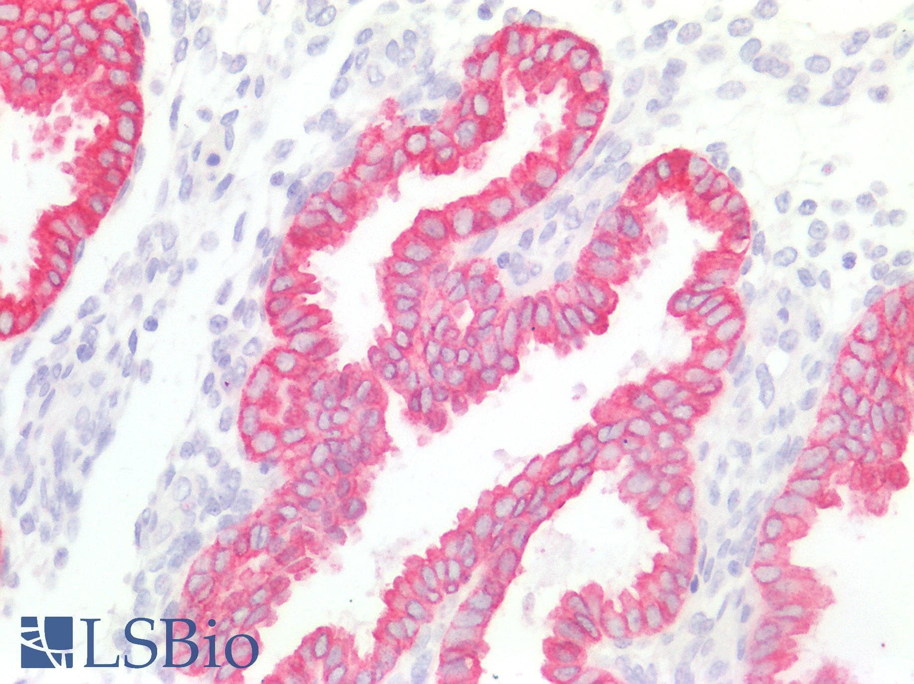 PathPlus™ Polyclonal Guinea pig anti-Human Pan Cytokeratin Antibody (IHC, WB)