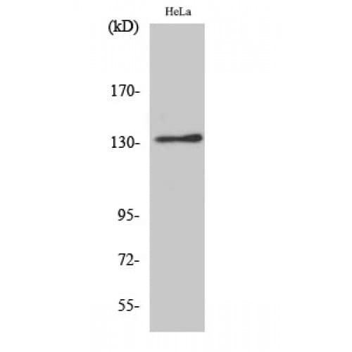 Polyclonal Rabbit anti-Human ITGAV/Integrin Alpha V/CD51 Antibody (Internal, IHC, WB)