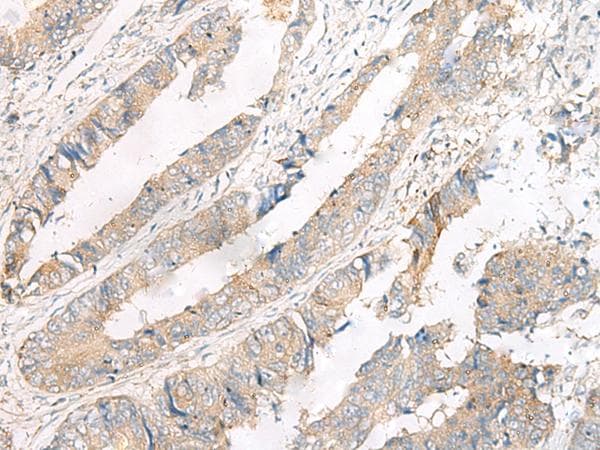 NATO3 / FERD3L Antibody