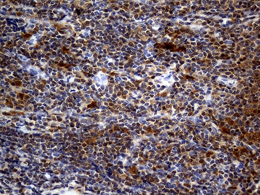 DAPP1 / BAM32 Antibody (clone OTI7D4)