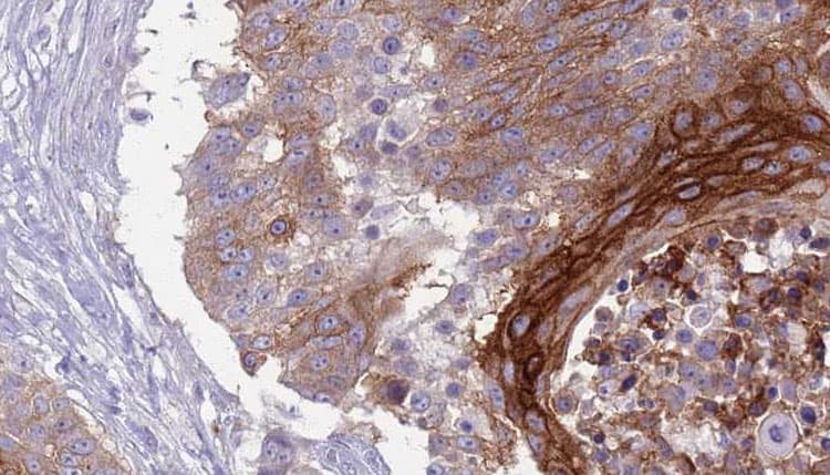 SLAMF1 / SLAM / CD150 Antibody