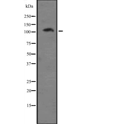 DAP-5 / EIF4G2 Antibody