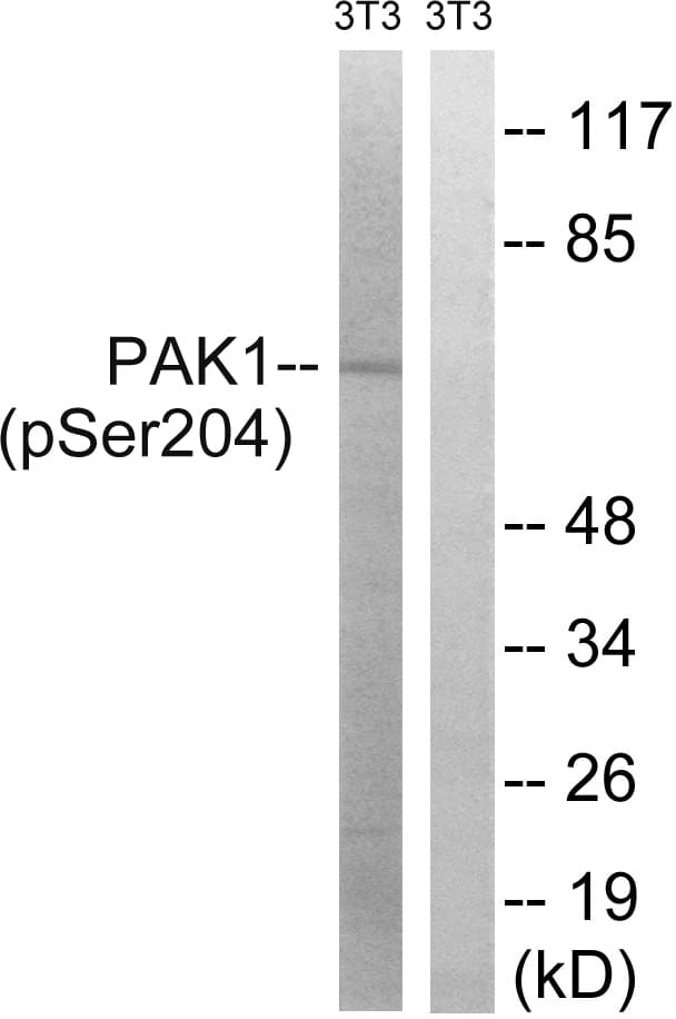 PAK1 Antibody (phospho-Ser204)