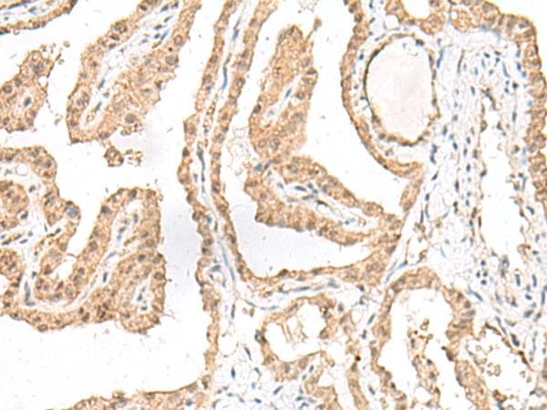 GARNL1 / RALGAPA1 Antibody