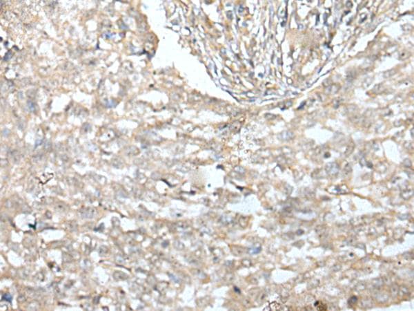 Polyclonal Rabbit anti-Human Villin-Like / VILL Antibody (IHC)