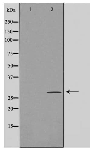 LRAT Antibody