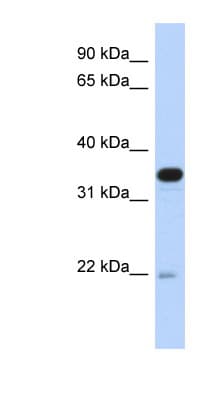 Polyclonal Rabbit anti-Human PITPNB Antibody (aa107-156, WB)