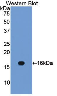 CAV1 / Caveolin 1 Antibody (aa2-104, Cy3)