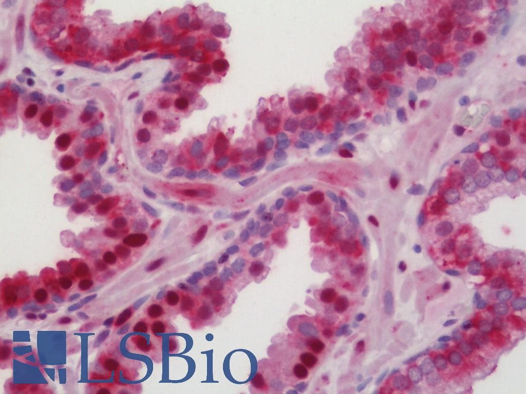 IHC-plus™ DNAL4 / Dynein Light Chain 4 Antibody (aa1-50)