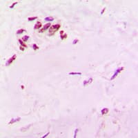 SOX6 Antibody (N-Terminus)