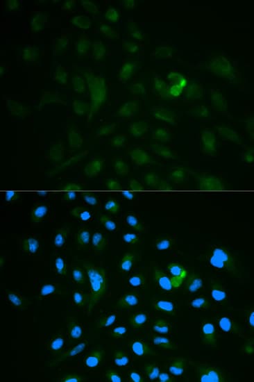 Polyclonal Rabbit anti-Human CD79B / CD79 Beta Antibody (IHC, IF, WB)