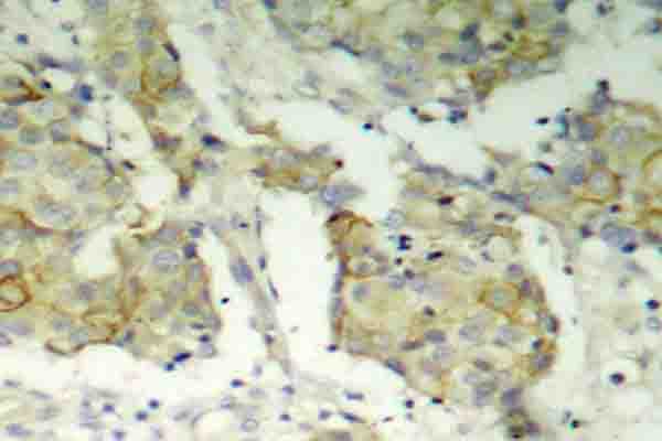 KDR / VEGFR2 / FLK1 Antibody (phospho-Tyr1214)