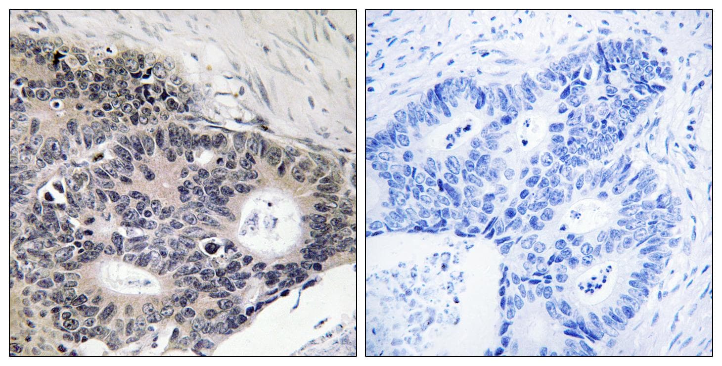 Polyclonal Rabbit anti-Human ABHD12B Antibody (IHC)