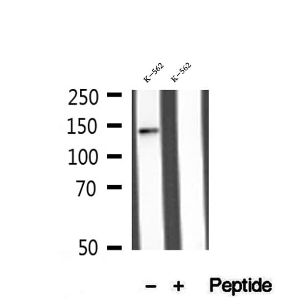 MLXIP / MONDOA Antibody