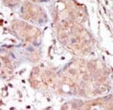 Polyclonal Rabbit anti-Human MAK Antibody (aa578-608, IHC, WB)
