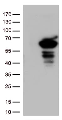 Monoclonal Mouse anti-Human SQSTM1 Antibody (clone UMAB13, IHC, IF, WB)