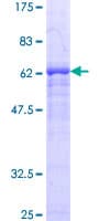 Human SIRT2 / Sirtuin 2 Protein (Recombinant GST)
