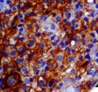 CD274 / B7-H1 / PD-L1 Antibody (clone RBT-PDL1)