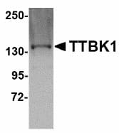 IHC-plus™ Polyclonal Rabbit anti-Human TTBK1 Antibody (IHC, IF, WB)