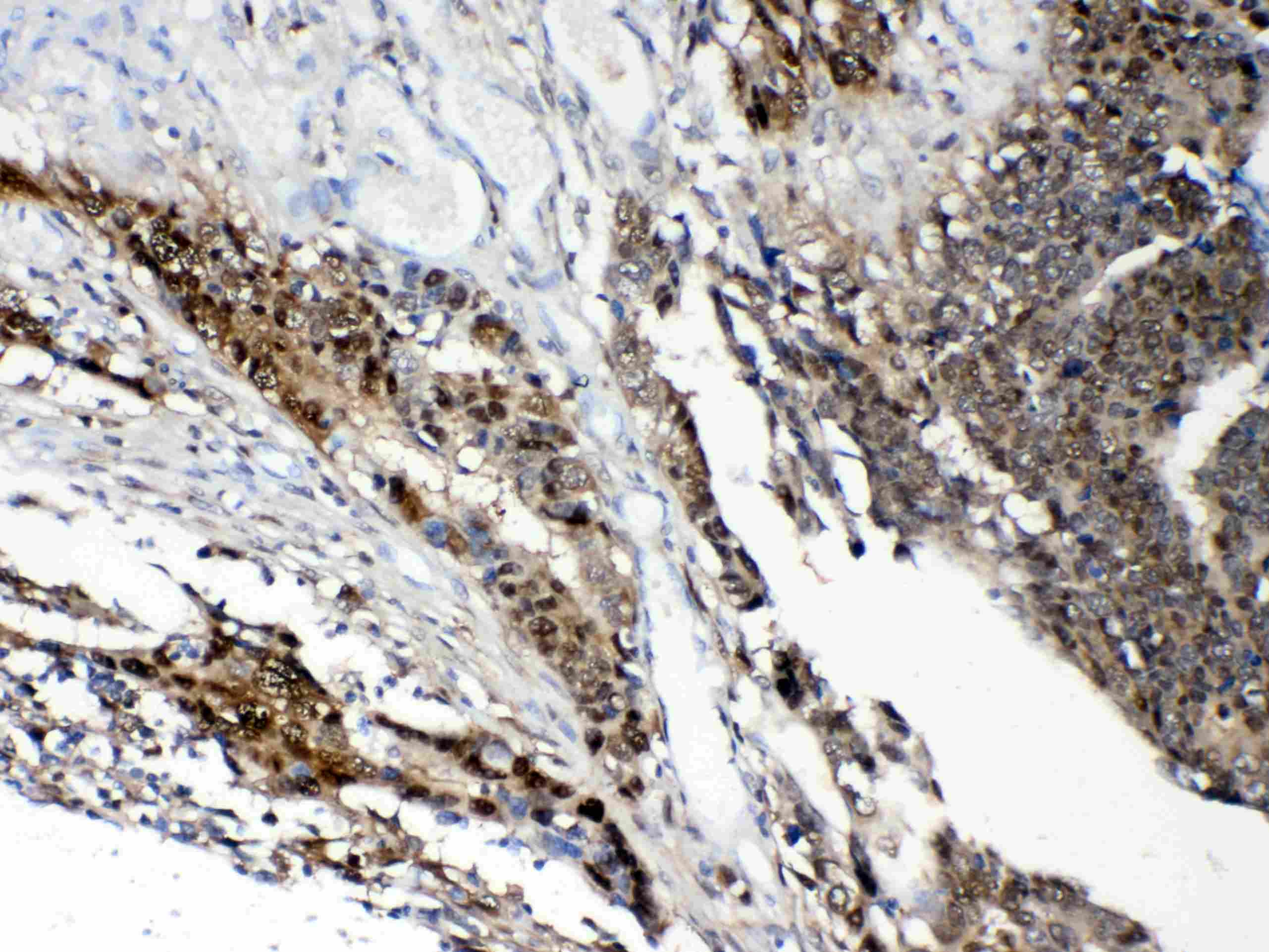 STAT1 Antibody