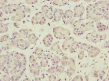 Dynactin 3 / DCTN3 Antibody
