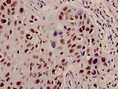 HIST1H4I Antibody