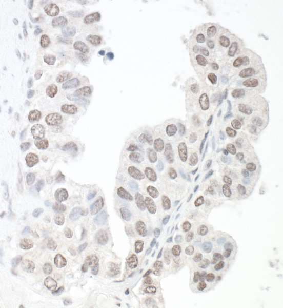 Polyclonal Rabbit anti-Human SMC6 Antibody (aa1050-C-term, IHC)
