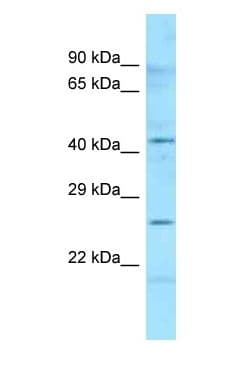 HLA-DMB Antibody (aa40-89)
