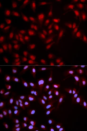 Polyclonal Rabbit anti-Human c-Met Antibody (phospho-Tyr1349, IHC, IF, WB)