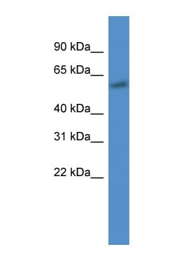 Polyclonal Rabbit anti-Human CYP7B1 Antibody (aa304-353, WB)