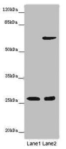 Polyclonal Rabbit anti-Human SOX14 Antibody (IHC, IF, WB)