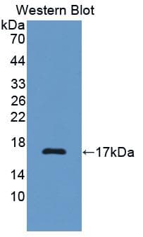 Complement C7 Antibody (aa1-144, FITC)