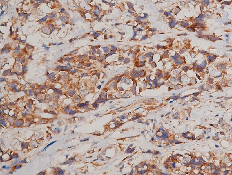 FLT1 / VEGFR1 Antibody