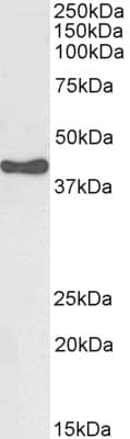 IHC-plus™ Polyclonal Goat anti-Human HSD3B1 Antibody (aa362-373, IHC, WB)