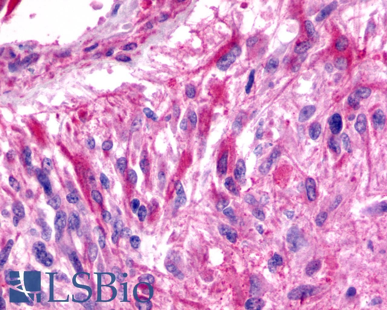 PathPlus™ Polyclonal Rabbit anti-Human ADGRB3 / BAI3 Antibody (Cytoplasmic Domain, IHC)