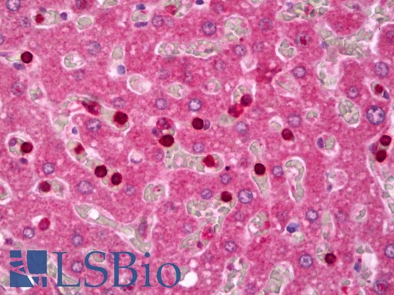 PathPlus™ IGFBP5 Antibody
