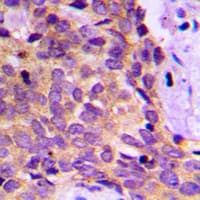 Polyclonal Rabbit anti-Human PRKAR1B Antibody (Internal, IHC, WB)