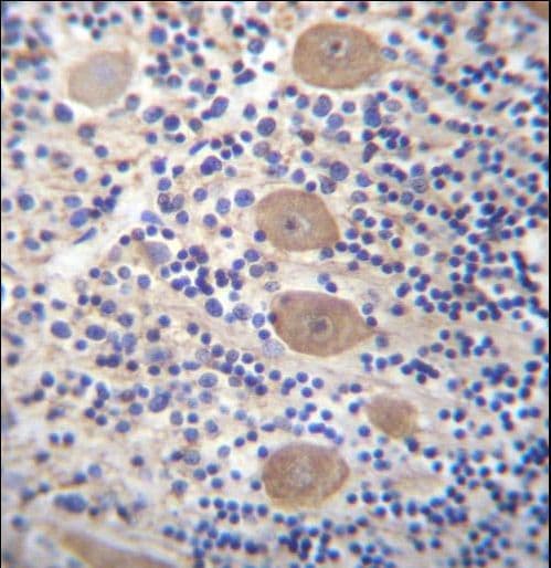 EAPP Antibody (aa204-233)