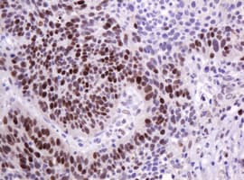 PCNA Antibody (clone OTI4B2)