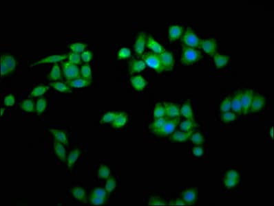 Polyclonal Rabbit anti-Human MCTS1 Antibody (aa1-181)